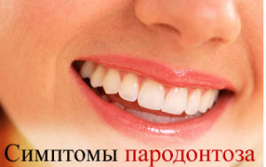 Пародонтоз — причины и симптомы