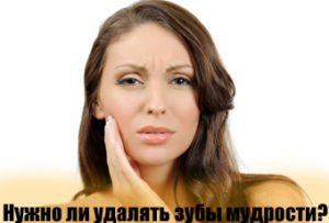 Стоит ли удалять зубы мудрости?