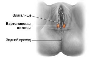 Киста бартолиновой железы