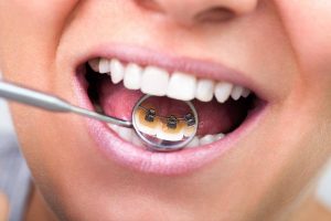 Как выбрать стоматологическую клинику: Советы