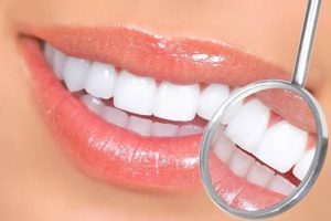 Как отбелить зубы: практичные методы