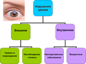 Типы нарушения зрения
