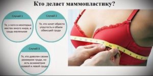 Делать ли маммопластику