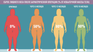 В чем суть и преимущества бариатрической операции?