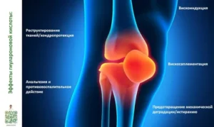 Гиалуроновая кислота в суставы: что это, для кого показано, эффективность и безопасность