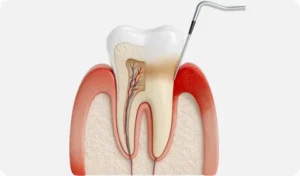 Що таке пародонтологія?
